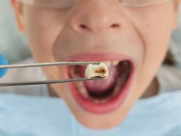 Best Emergency Dentist No Insurance  in Barrett, TX
