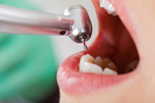 Best Walk-In Dentist Near Me  in Barrett, TX